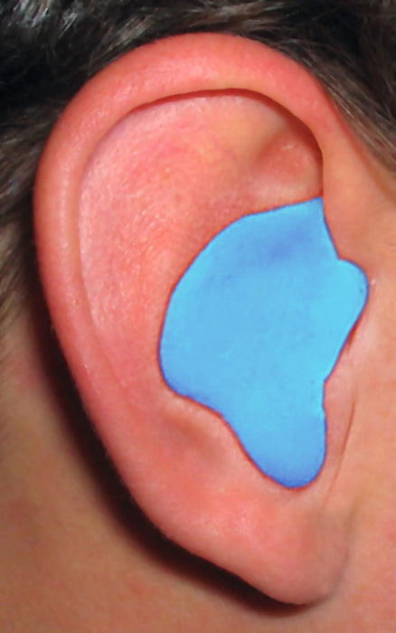 Radians Blue Custom Molded Earplugs RNSCEP002-B